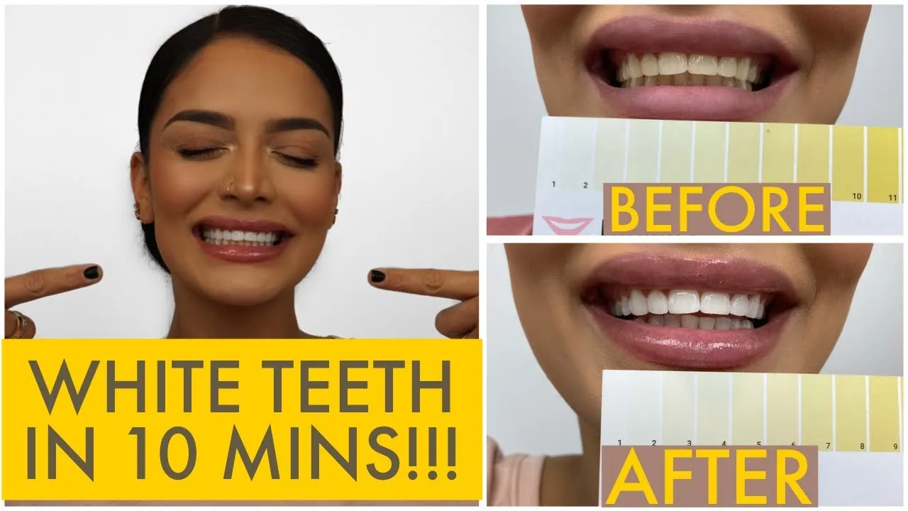 28289 hismile kit steps