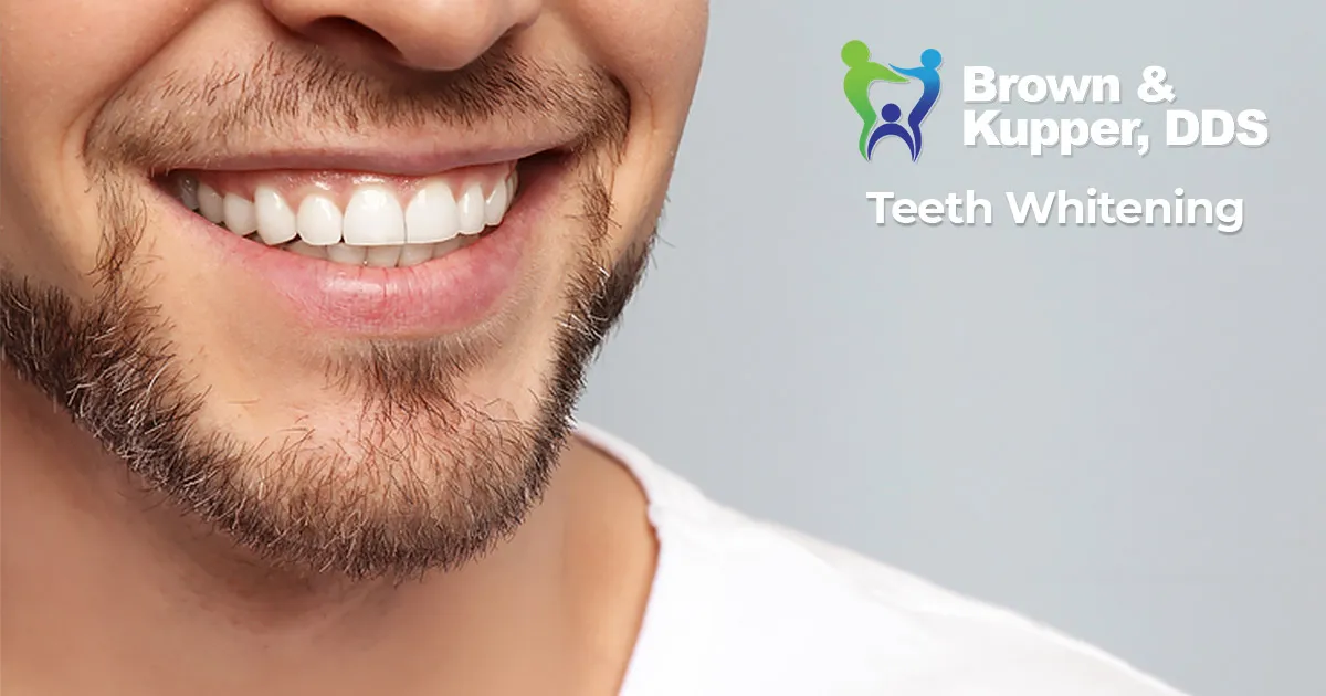 28303 discolored teeth