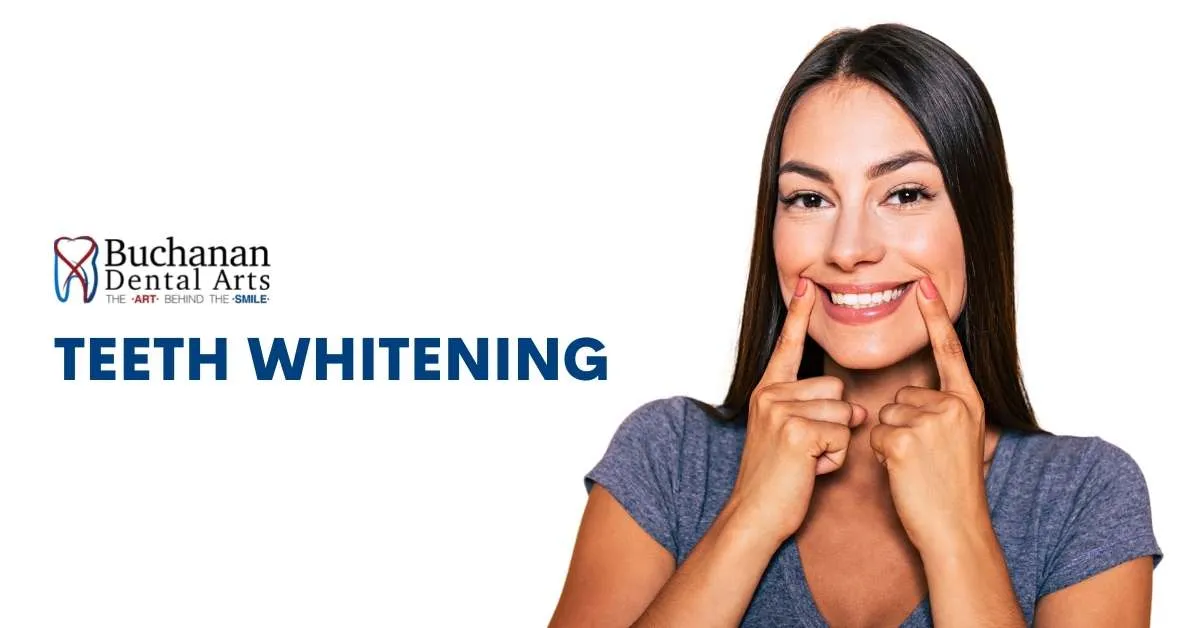 28303 professional teeth whitening