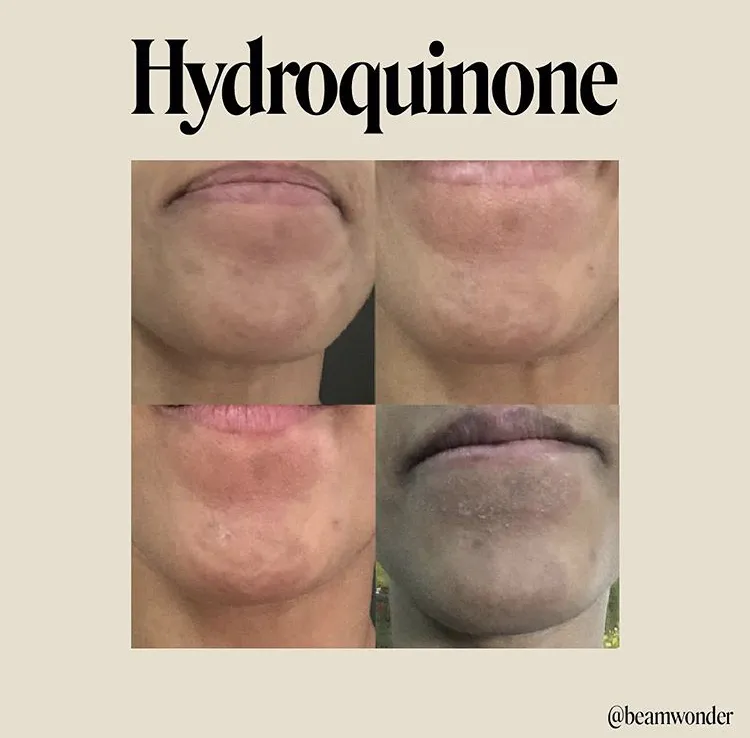 28304 sun protection