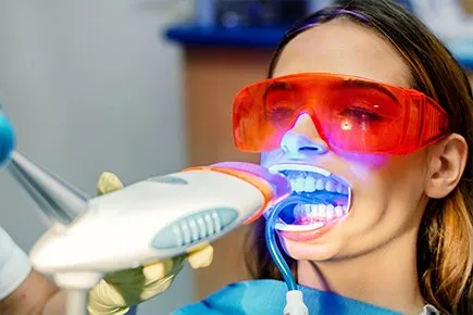 28305 teeth whitening results