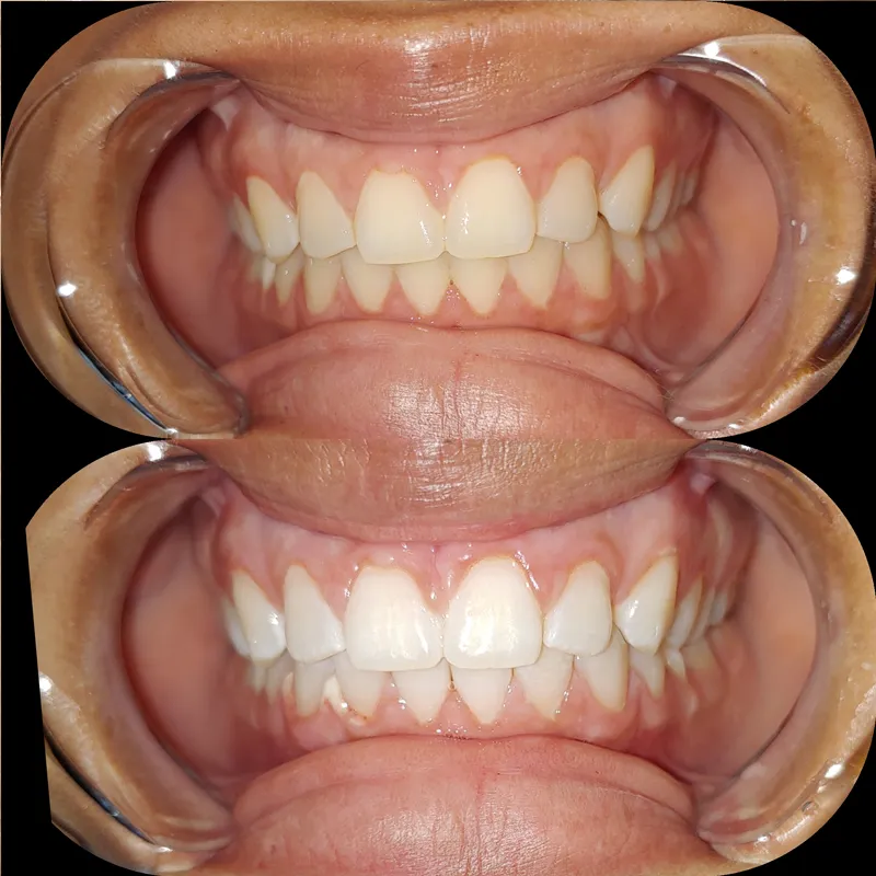 28308 customer reviews teeth