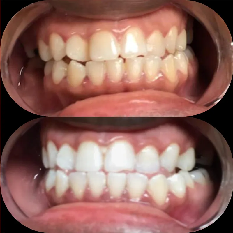 28308 new orleans teeth