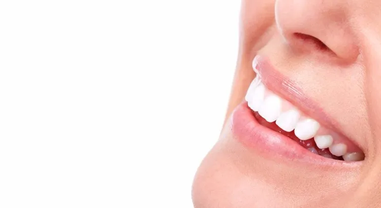 28313 teeth whitening cost