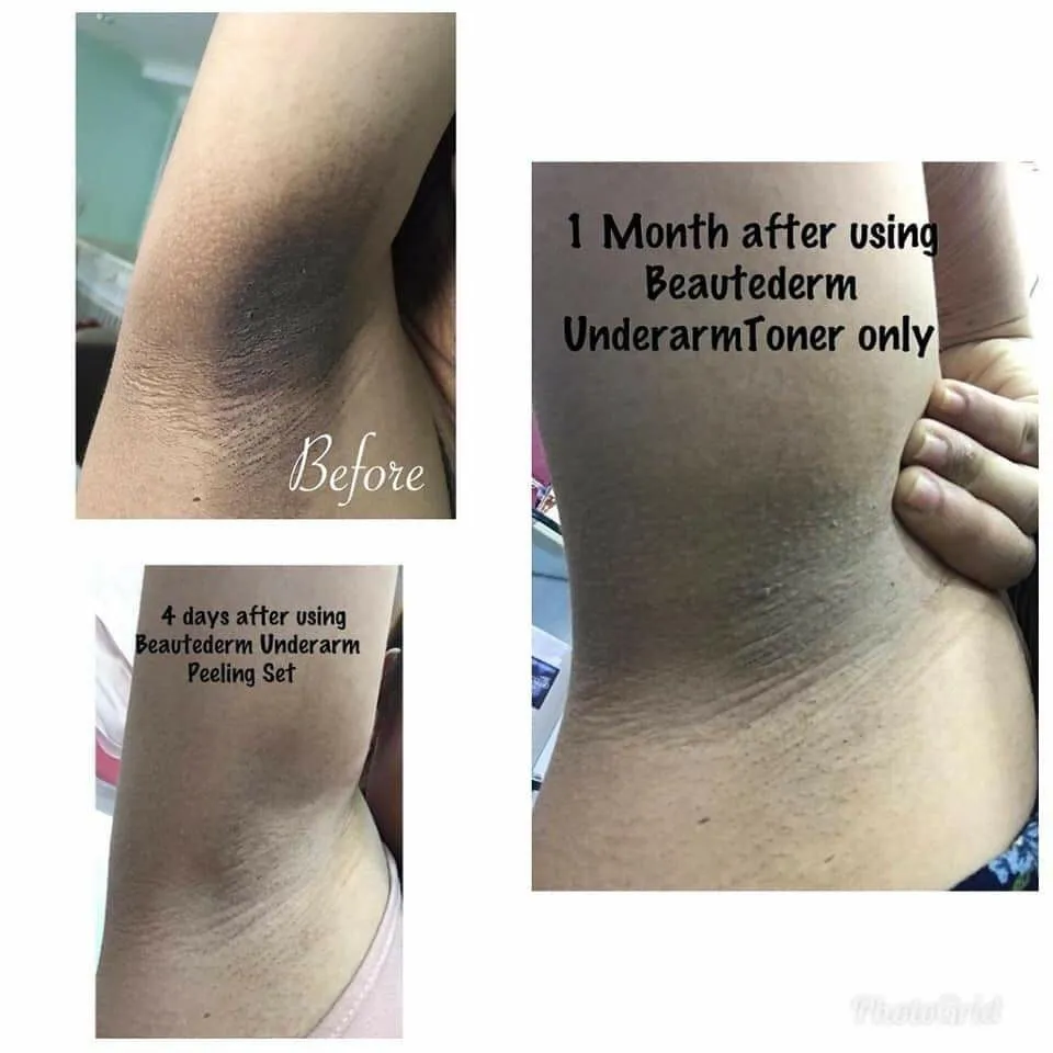 28314 beautederm customer review