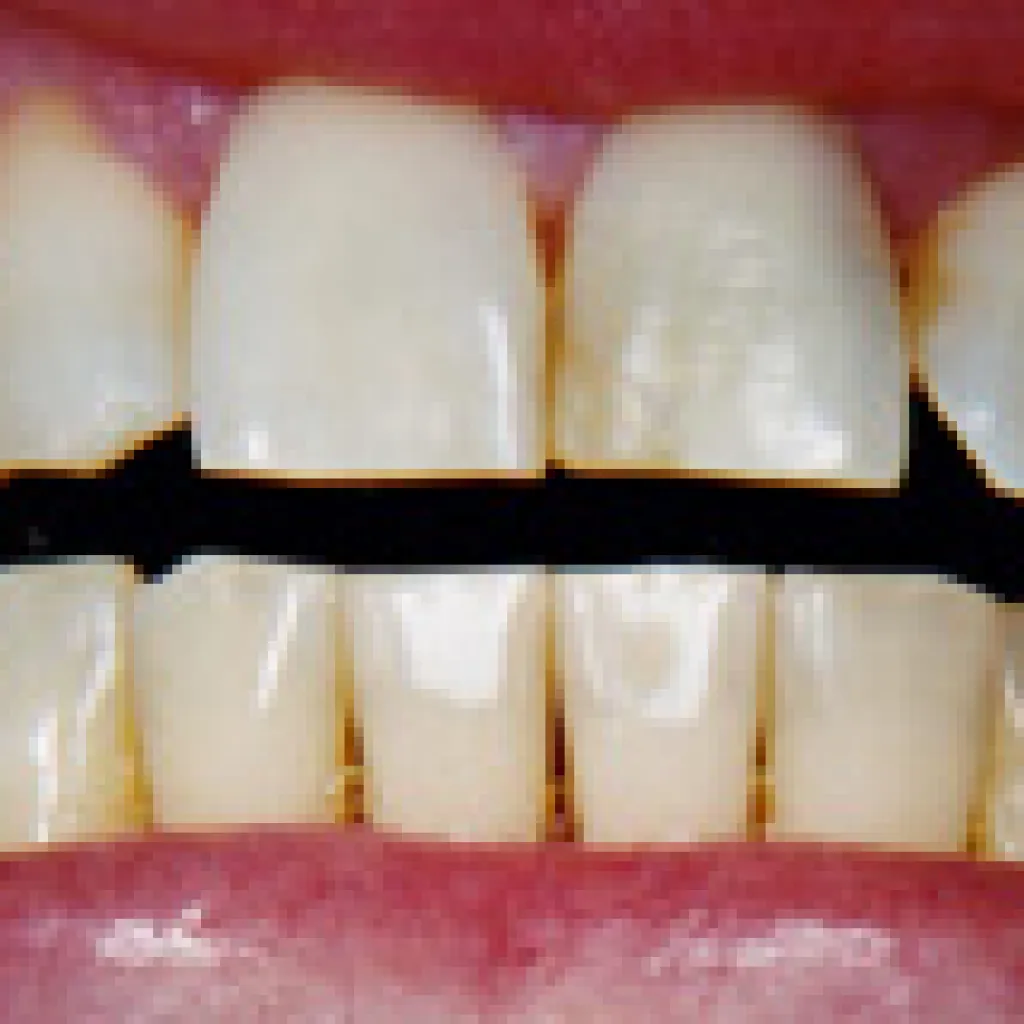 28320 sensitivity toothpaste