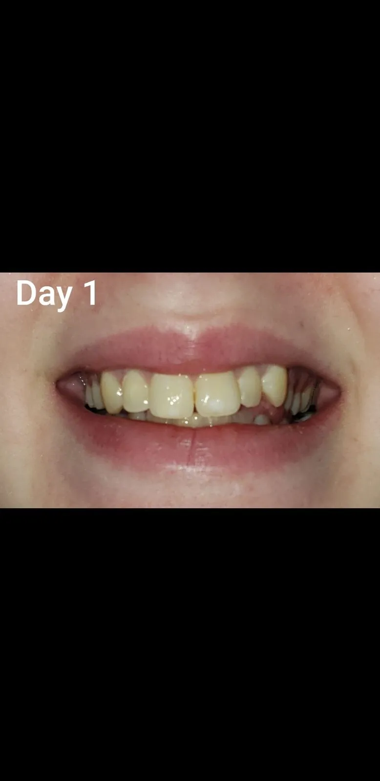 28321 charcoal pills ingredients