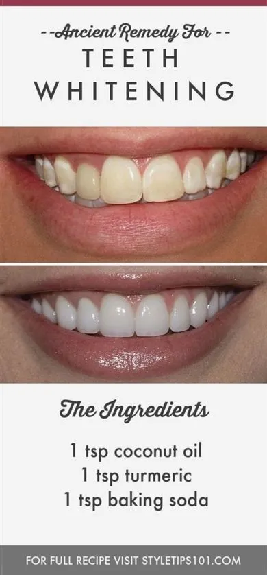 28332 sensitive teeth