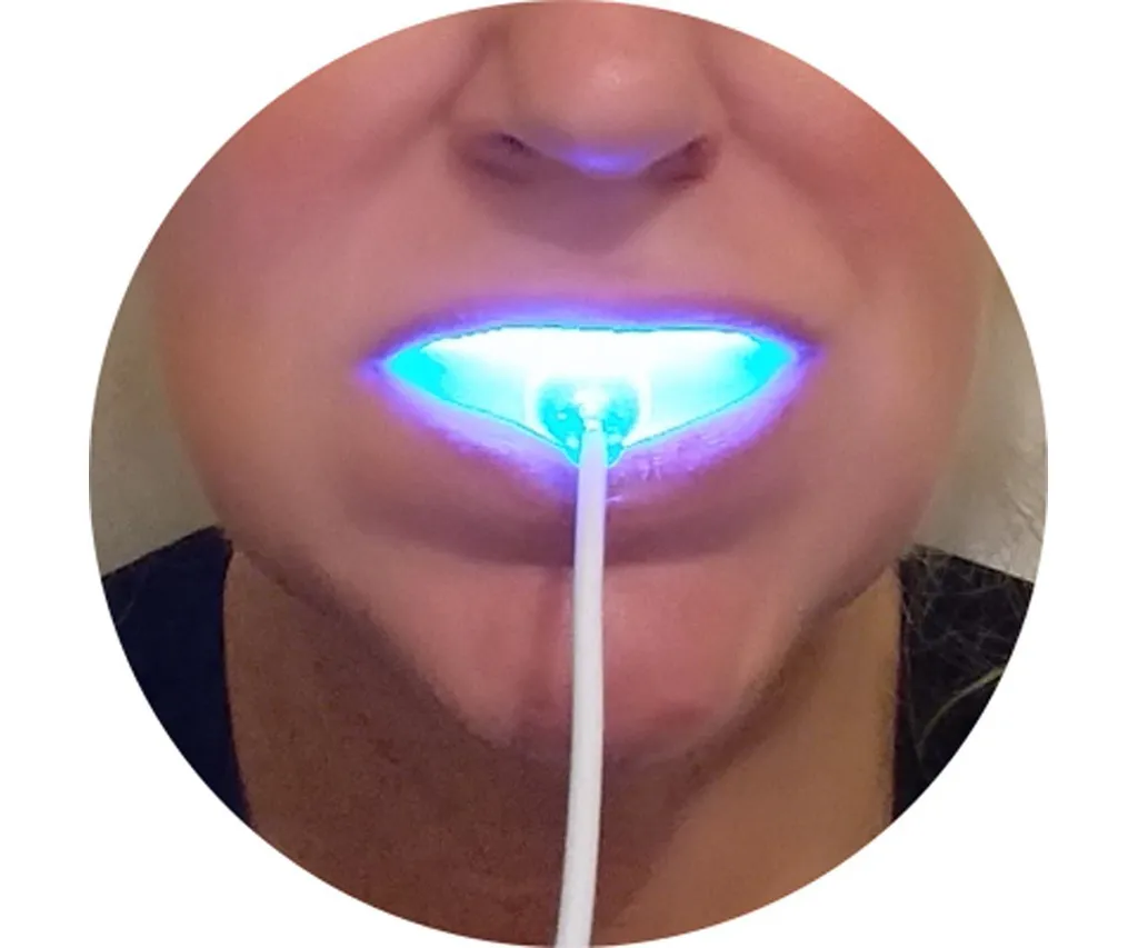 28335 led light teeth whitening pros