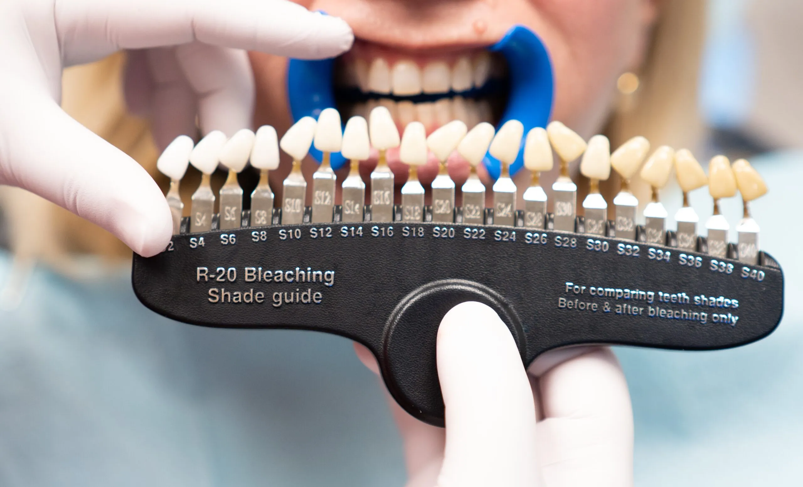 28337 oral hygiene tips