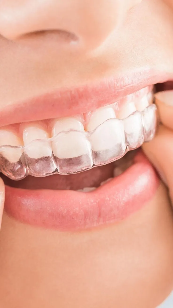 28343 post whitening care