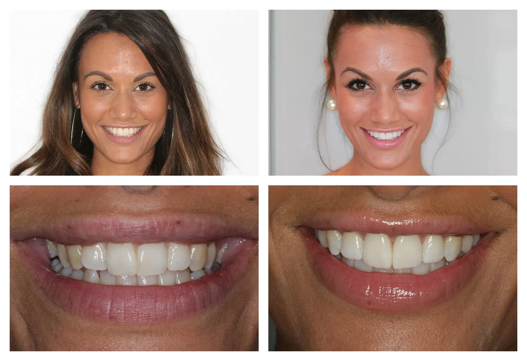 28343 teeth whitening products
