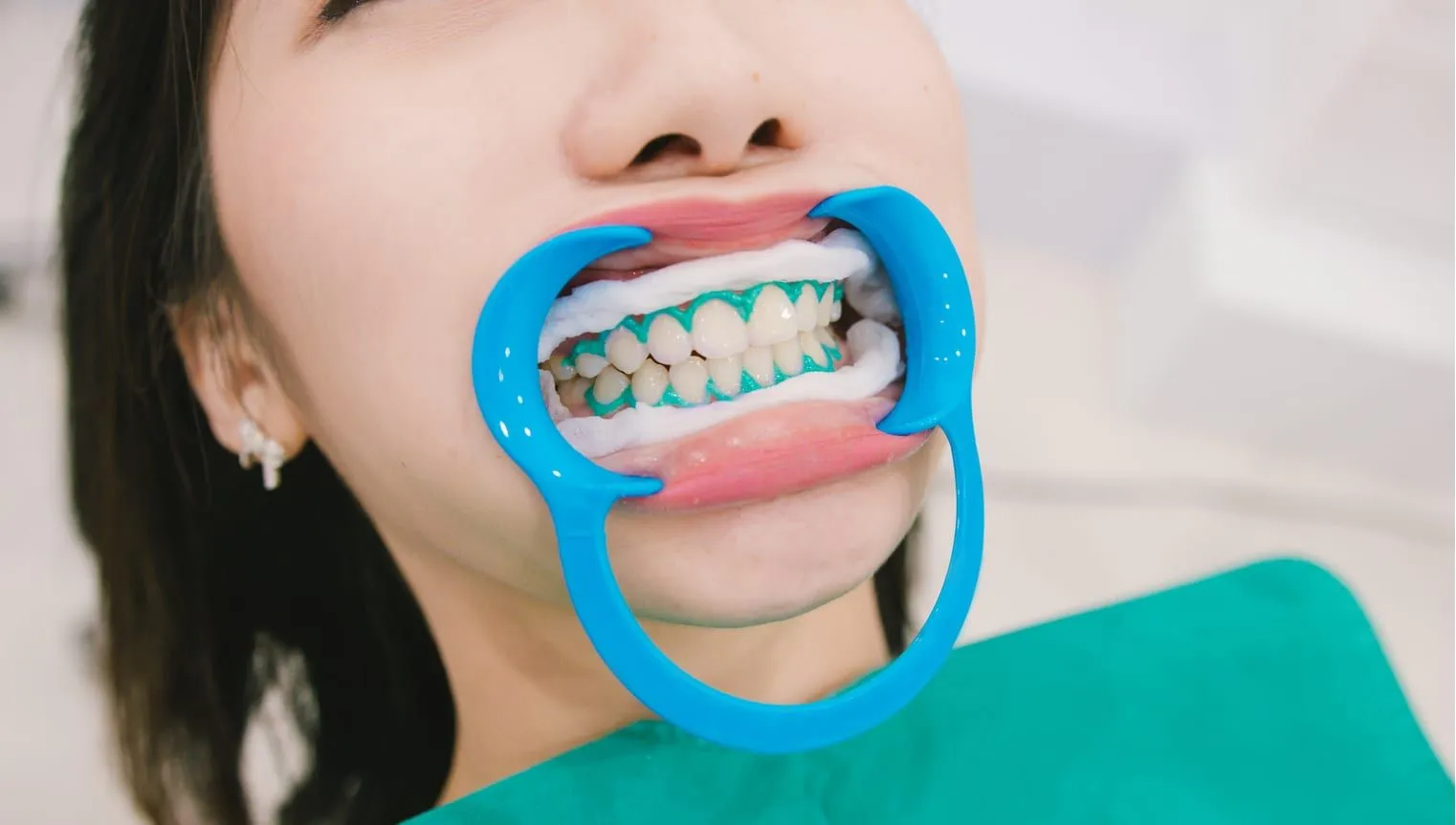 28353 maintaining white smile