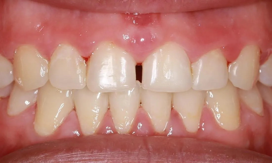 28358 improve oral hygiene