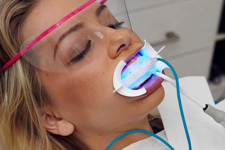 28364 teeth whitening gungahlin before and after