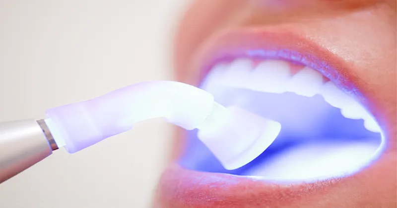 28364 teeth whitening gungahlin oral hygiene