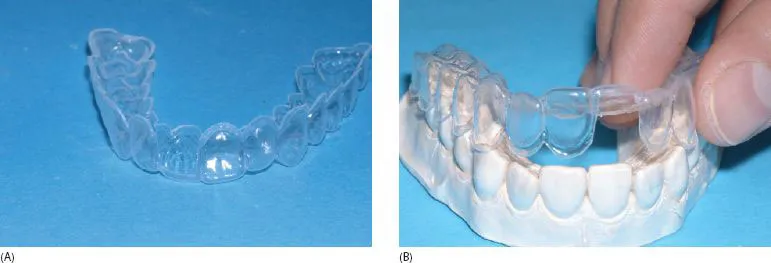 28367 mint dentistry whitening trays 3