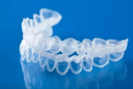 28367 mint dentistry whitening trays 6