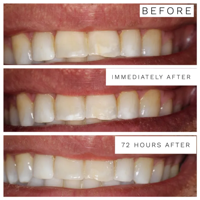 28369 healthy gums