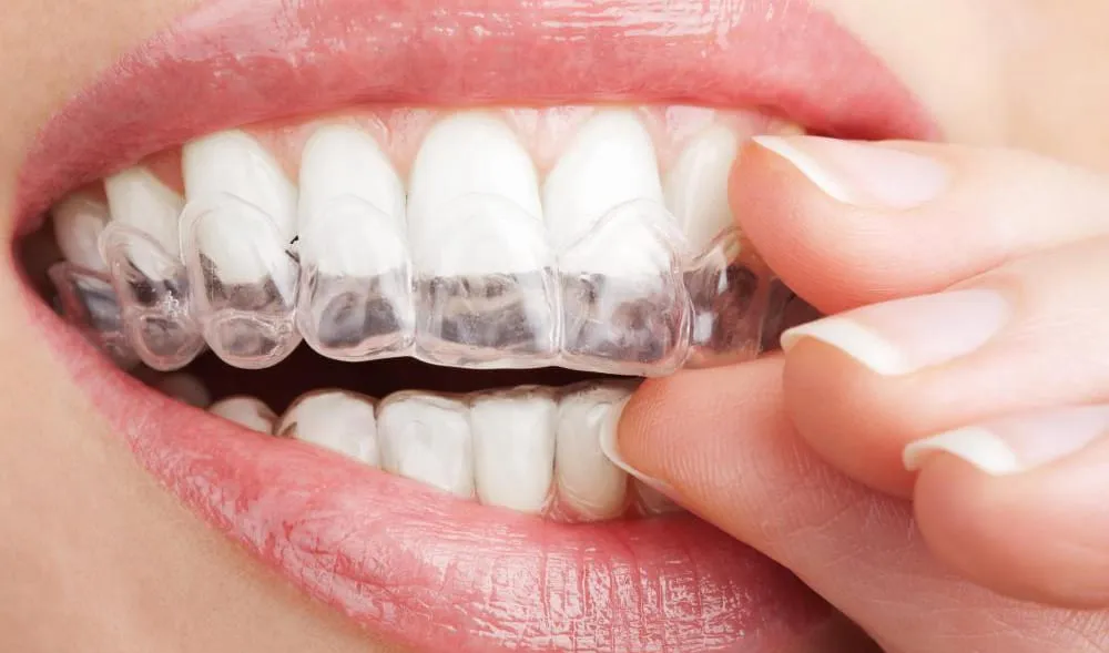 28378 hydrogen peroxide teeth