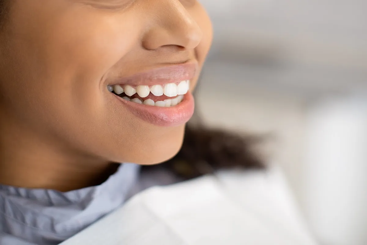 28378 white patches gums