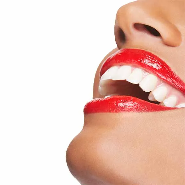 28382 whitening maintenance