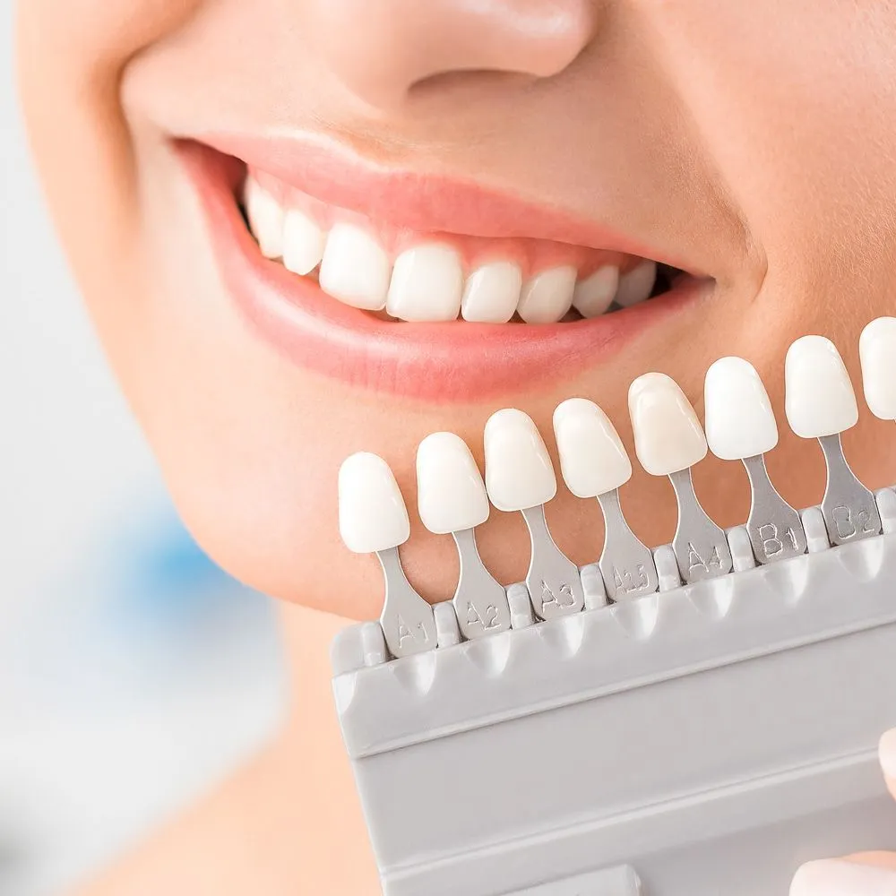 28393 teeth whitening aftercare