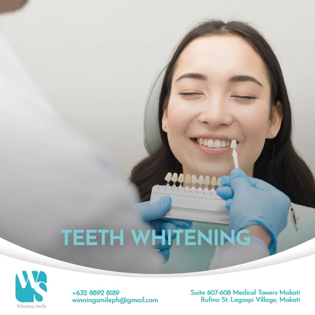 28399 over the counter whitening