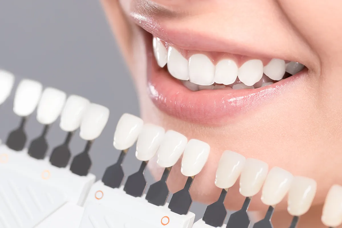 28403 teeth whitening barcelona clinic