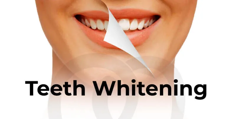 /img/28403-teeth-whitening-barcelona-food-drinks.webp
